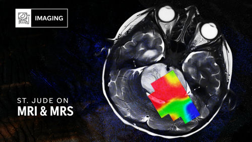 image for St. Jude On article on MRIs