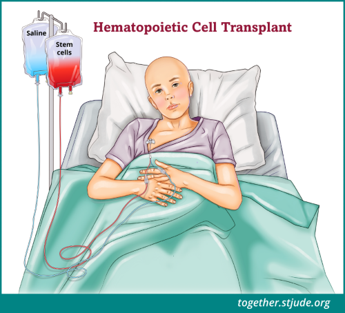 hematopoietic stem cell transplantation