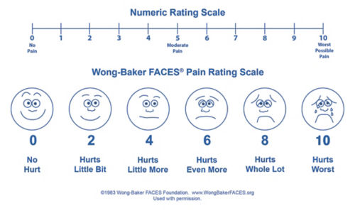 Pain scale example that shows a series of faces that change from a happy face depicting no pain to a sad and crying face to show the worst pain.